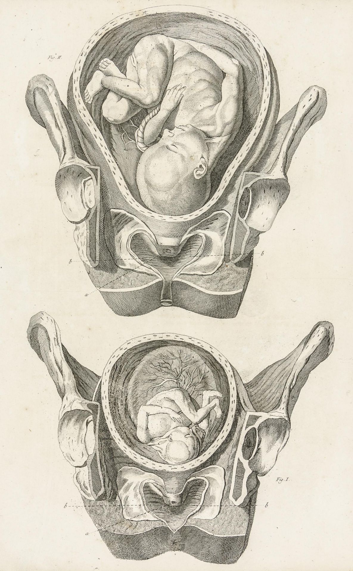 Medizin - Geburtshilfe - Mohrenheim, - Bild 3 aus 5