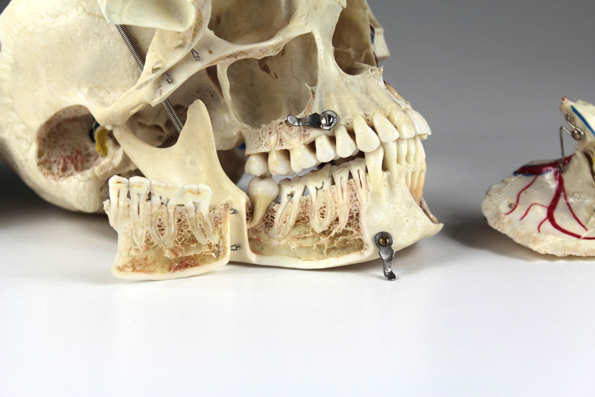 Anatomisches Schädelpräparat - Bild 5 aus 6