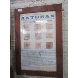 An information poster for a factory, showing signs and symptoms of Anthrax, 20ins x 12ins
