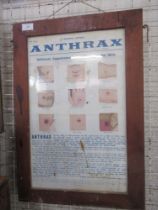 An information poster for a factory, showing signs and symptoms of Anthrax, 20ins x 12ins