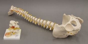 A model of a human spine and another medical model. The former 73 cm high.