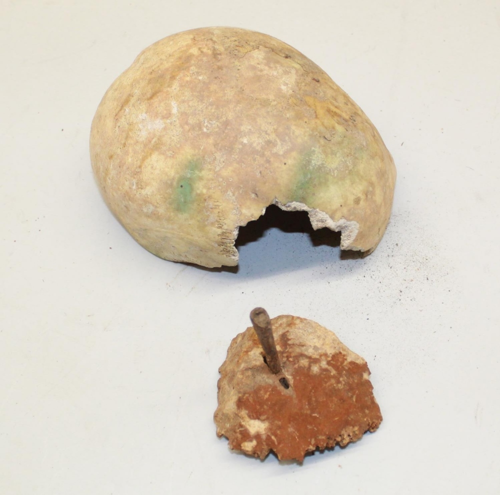 WITHDRAWN Two sections of ancient human skull, one with a protruding arrowhead. (Victor Brox colle - Image 2 of 2