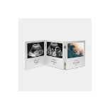 Bundle of 2x Baby Scan Photo Frame - ER23