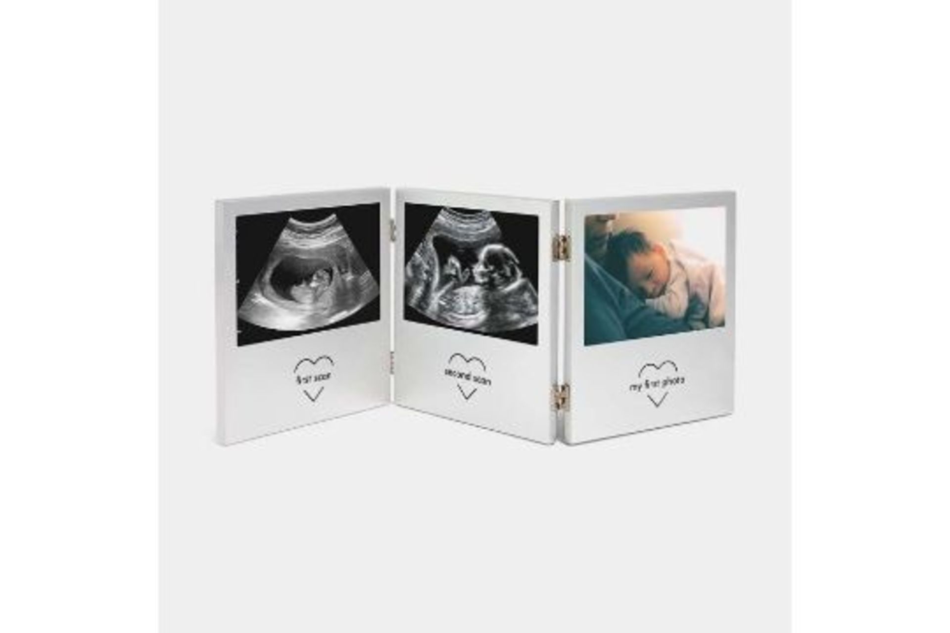 Bundle of 2x Baby Scan Photo Frame - ER23