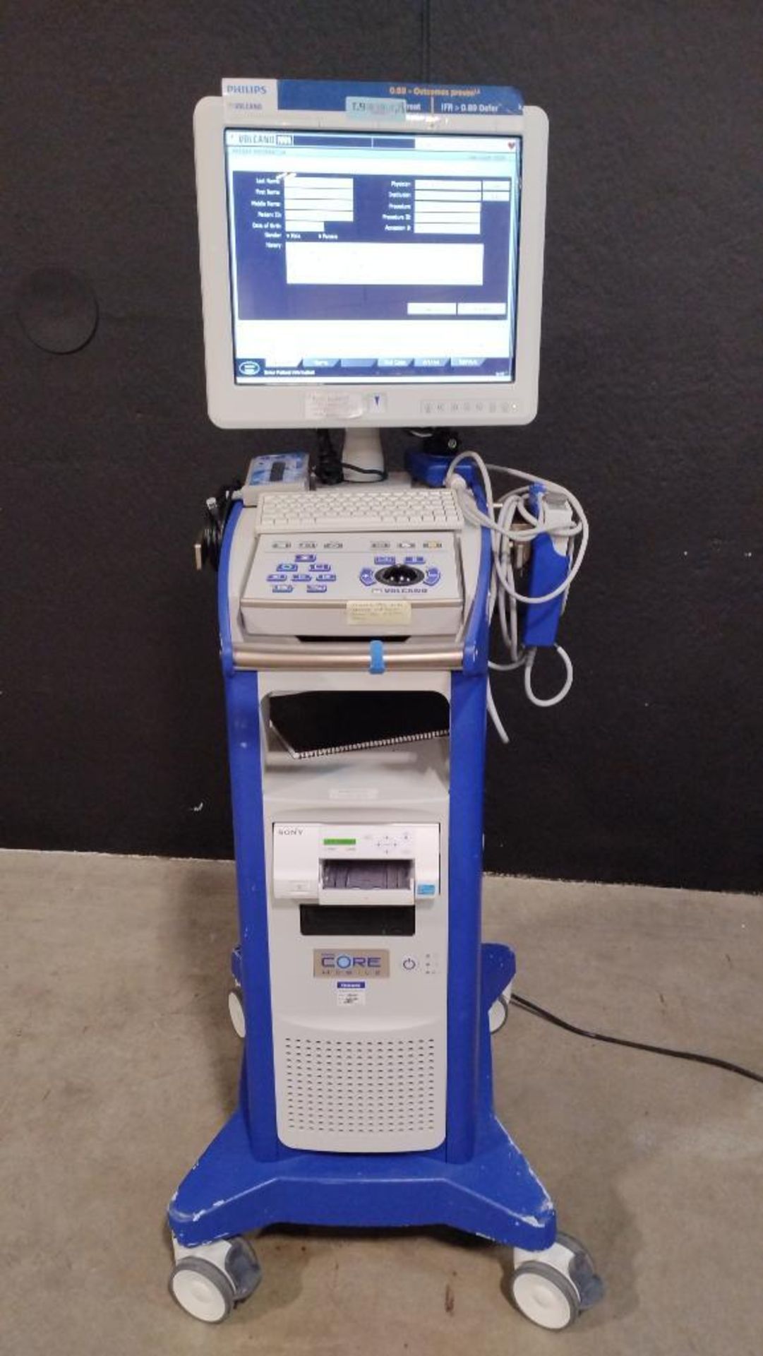 VOLCANO CORE MOBILE PRECISION GUIDED THERAPY SYSTEM