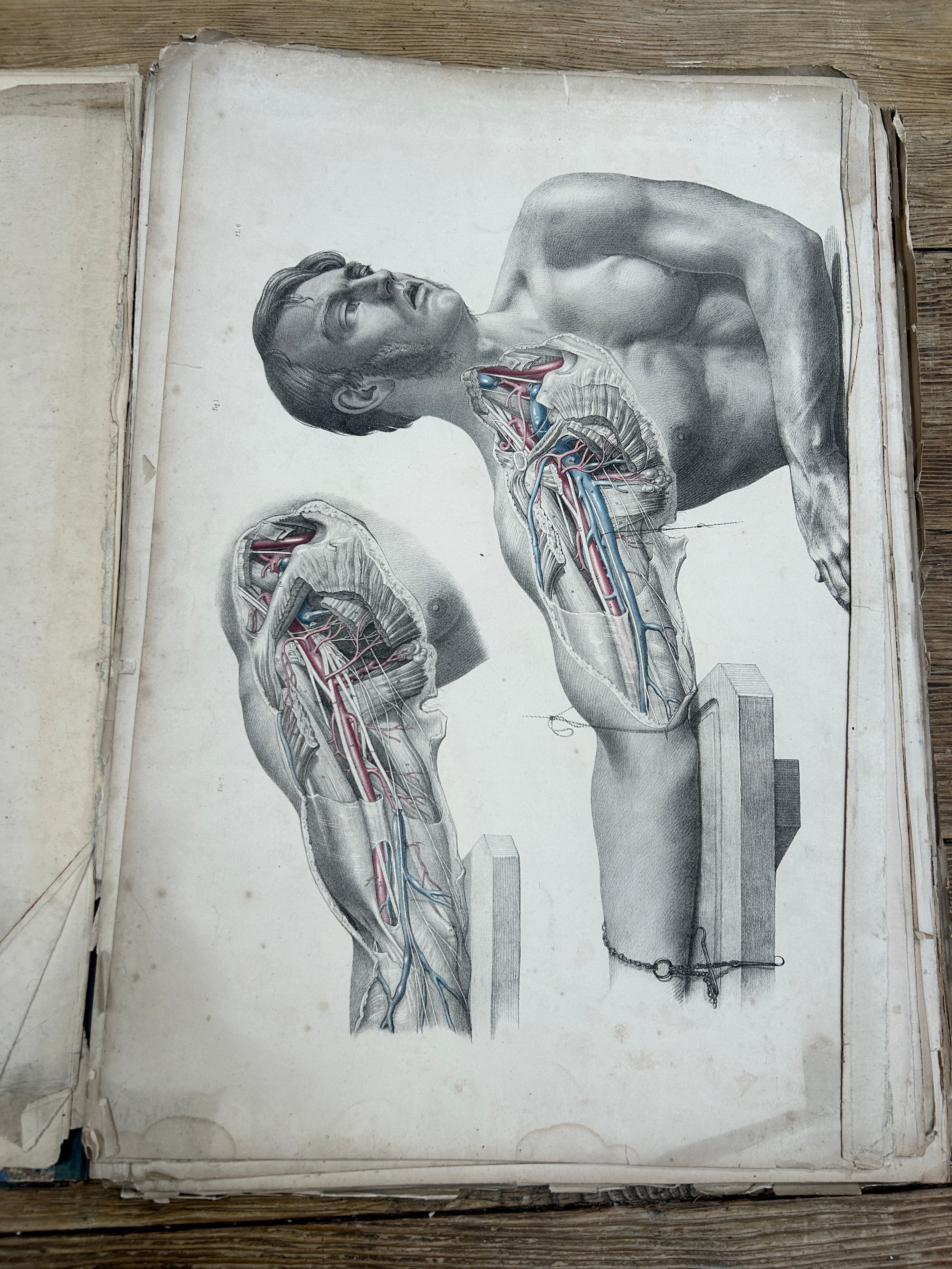 JOSEPH MACLISE: 'FROM SURGICAL ANATOMY' 1851: A QUANTITY OF LOOSE, LARGE HAND COLOURED STEEL - Image 3 of 5