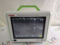 CASMED Foresight Elite Patient Monitor - 510680