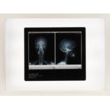 § Damien Hirst (British, b.1965) Self-Portrait